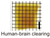 Human brain tissue large blocks cleared by CUBIC