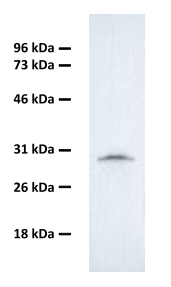 Figure 5. Western blotting of isolated exosomes using E1601