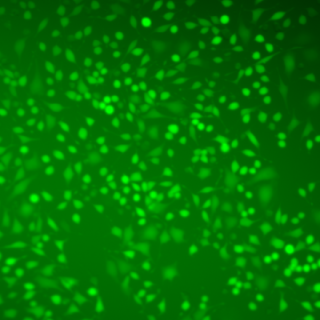 Fluorescence microscopy observation of ROS produced in Hela cells