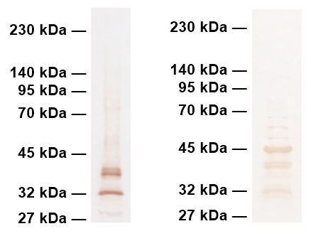 Western blot image of proteins extracted from E. coli and S. cerevisiae